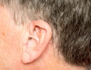 Macro close up of tiny modern hearing aid placed behind the ear of senior adult man