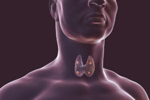 Thyroid and parathyroid glands in human body, 3D illustration - Hyperparathyroidism