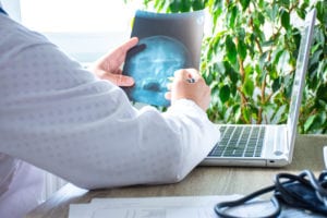 Doctor in office near computer considers and examines X-ray of human skull. Photo of process of diagnosis of disease or disorder of bone skull system, pathology of eye or ear, nose, cranial sinuses