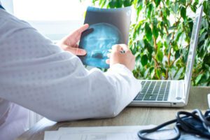 Doctor in office near computer considers and examines X-ray of human skull. Photo of process of diagnosis of disease or disorder of bone skull system, pathology of eye or ear, nose, cranial sinuses