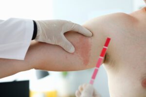 Allergist checking man irritated skin