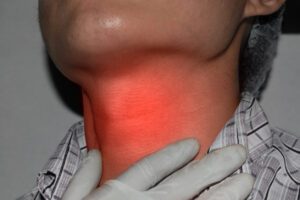 Concept of sore throat, laryngitis