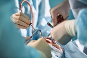 A doctor wearing gloves holds a medical instrument during an adenoidectomy surgery.